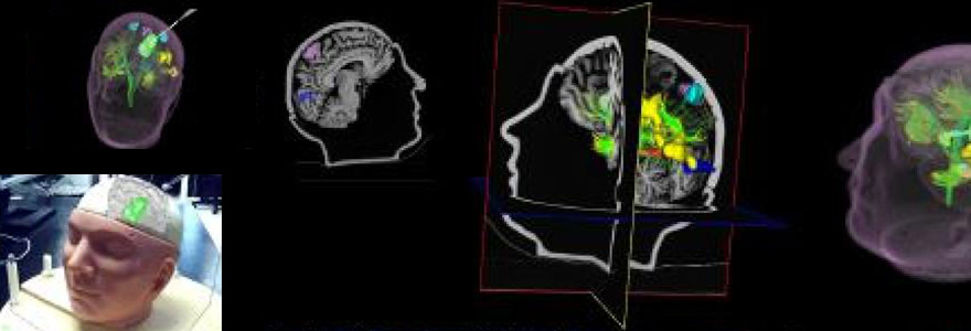 neurosugical_880x300.jpg