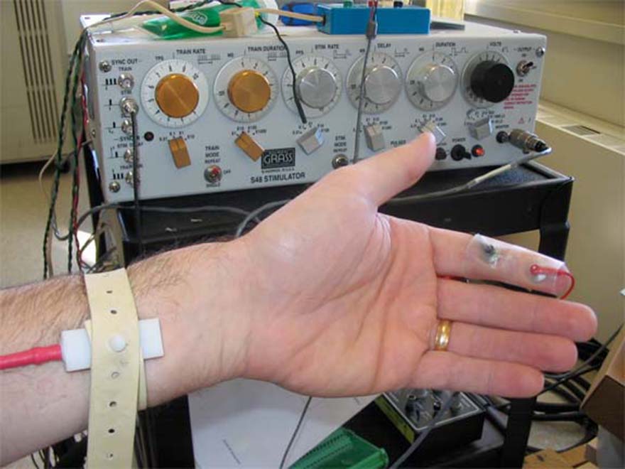 MR Safety: Respiratory Stimulators - Questions and Answers in MRI