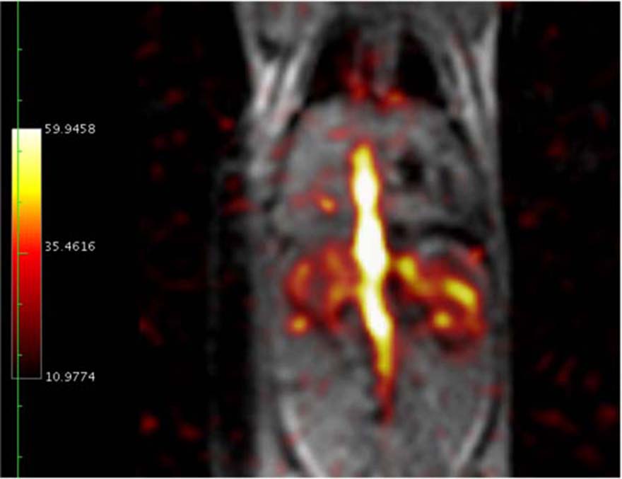 PyruvateKidneys.jpg